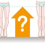 O脚矯正で身長が伸びるって本当？神戸の整骨院が詳しく解説