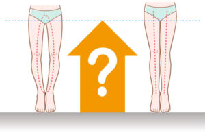 O脚矯正で身長が伸びるって本当?神戸の整骨院が詳しく解説